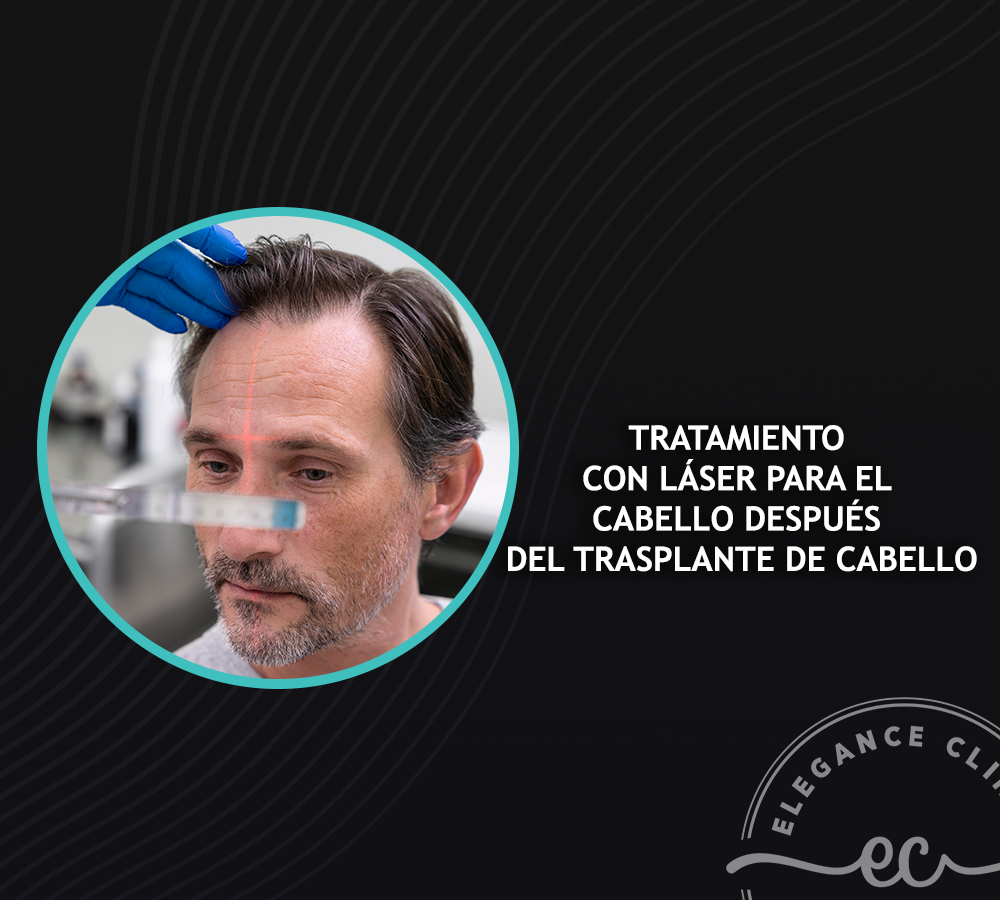 Tratamiento Con Láser Para El Cabello Después Del Trasplante De Cabello