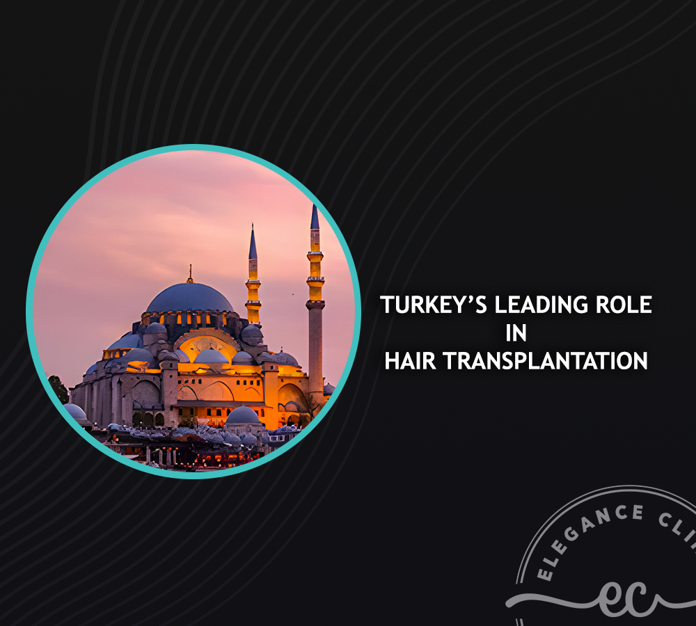 Turkey’s Leading Role in Hair Transplantation and Istanbul’s Unique Values