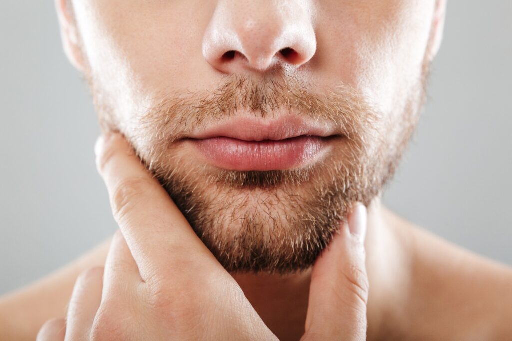 Beard Transplant in Turkey