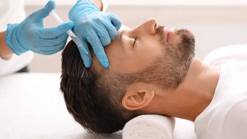 How Many Grafts Are Needed for Hair Transplantation?