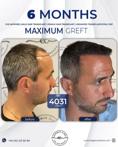 sac_ekimi_oncesivesonrasi_11