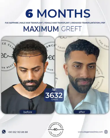 sac_ekimi_oncesivesonrasi_22