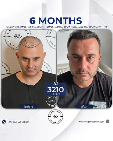 sac_ekimi_oncesivesonrasi_27