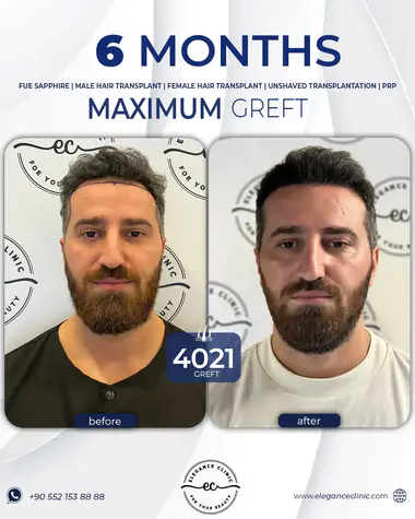 sac_ekimi_oncesivesonrasi_31