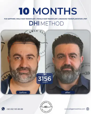 sac_ekimi_oncesivesonrasi_32