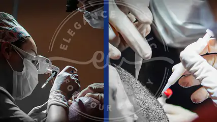 Metodi di Trapianto di Capelli: Differenze tra FUE e DHI