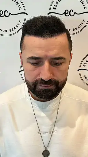 Öncesi–sonrası kısa video 5