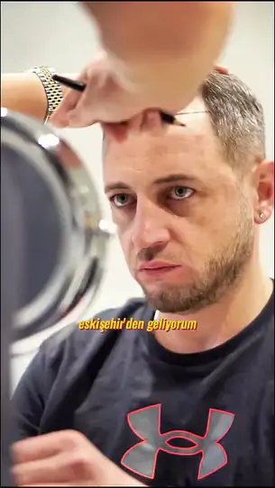 Öncesi–sonrası kısa video 6