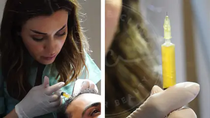 PRP Saç Ekimi: Ne Zaman, Neden ve Nasıl Uygulanmalı?