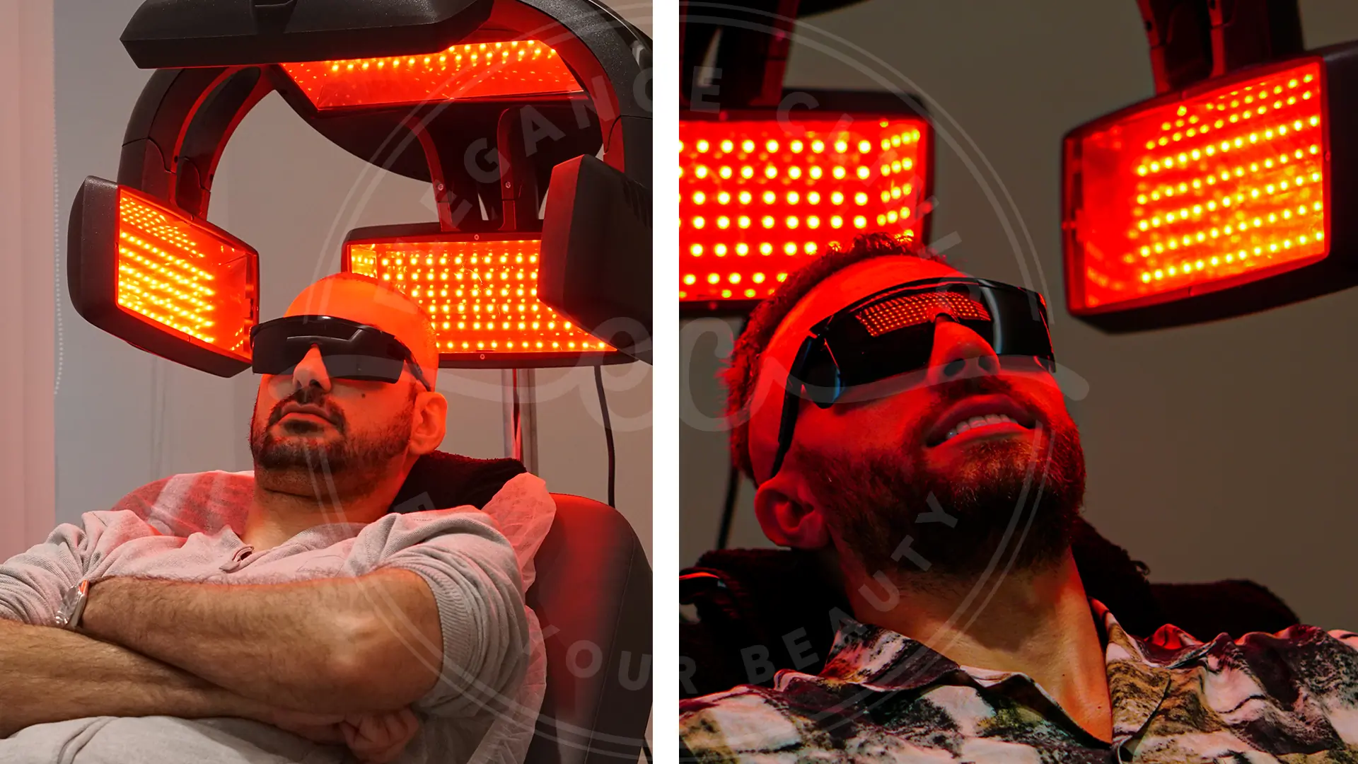 DHT kaynaklı saç dökülmesinde lazer destek tedavisi uygulaması