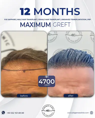 66