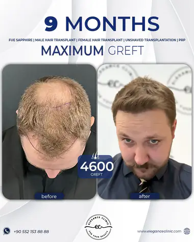 70