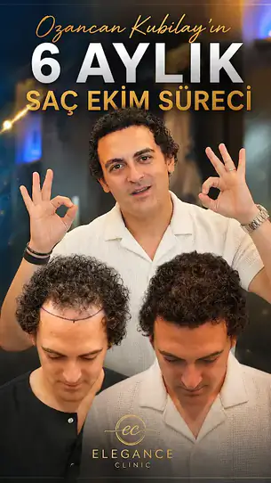 Öncesi–sonrası kısa video 4